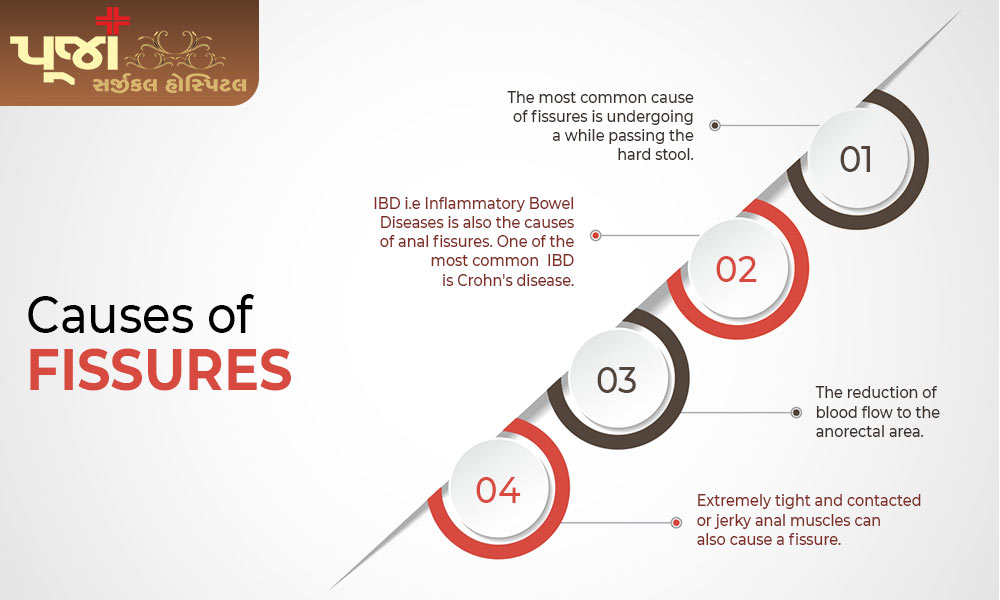 Causes of Fissures