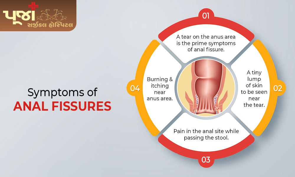 Symptoms of Anal Fissures