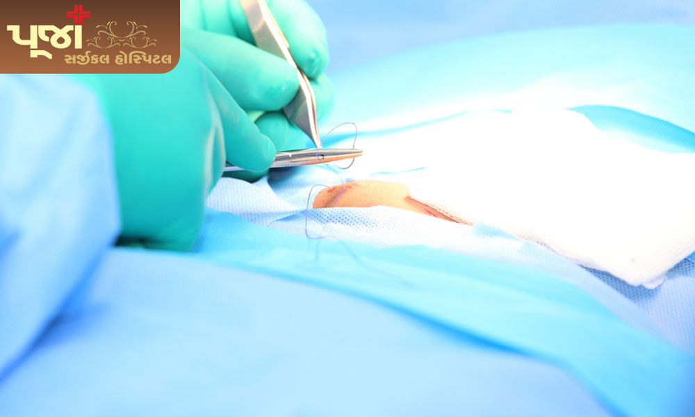What is Hernia Surgery