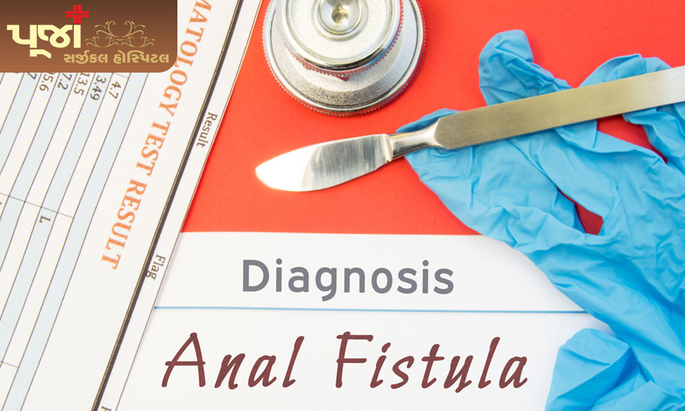 Anal Fistula