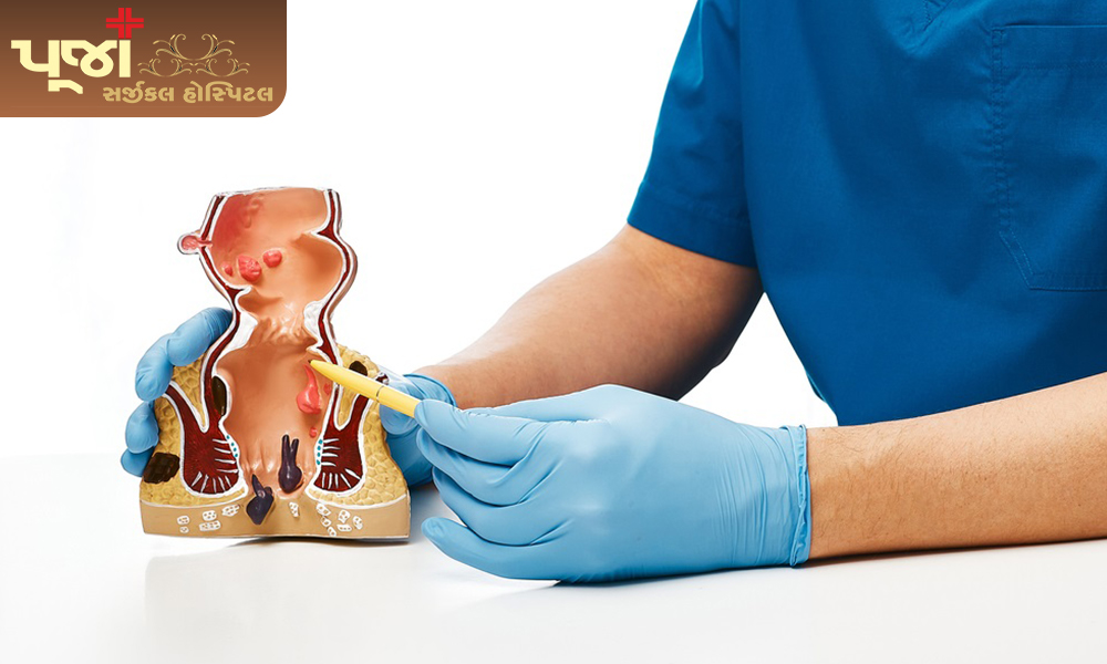 How Anal Fissure can be treated