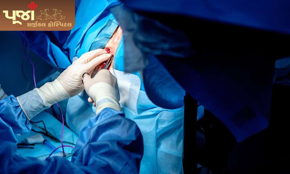 How to treat anal fissure effectively